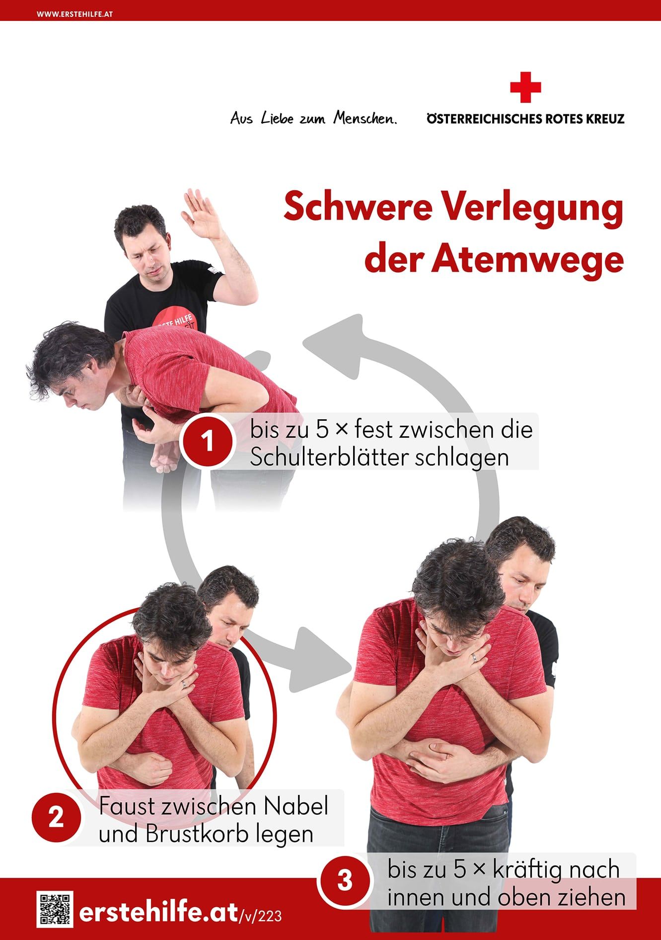 Schwere verlegung der Atemwege: 1. bis zu fünf mal fest zwischen die Schulterblätter schlagen, 2. Faust zwischen Nabel und Brustkorb legen, 3. Brustkorb bis zu 5x kräftig nach innen und oben ziehen